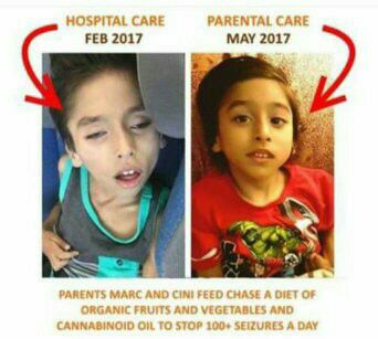 aussie child after cannabis oil 18556047_268126556986621_1502038132261123596_n