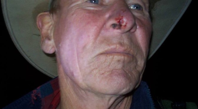 Unbelievably, the victim of an unprovoked assault (two reliable eye witnesses) who was concerned about 1080 storage in a CBD  has been charged with assault!