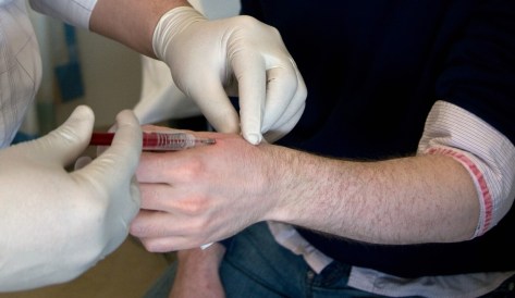 Copy2 of Dr_Mark_Gasson_has_an_RFID_microchip_implanted_in_his_left_hand_by_a_surgeon_(March_16_2009).jpg