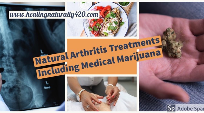 Natural Arthritis Treatments Including Medical Marijuana