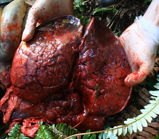 AUTOPSY LUNGS TRIM LOW