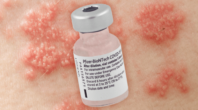 New Study Links “Acute Chest Pain” In Male Soldiers To mRNA Vaccines