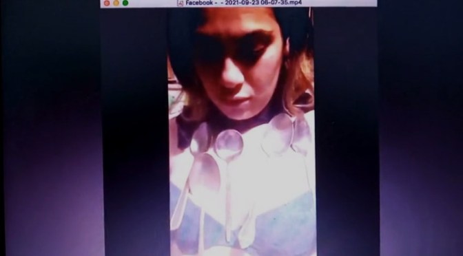 A young NZ woman magnetic after taking the Covid mRNA Experimental Injection